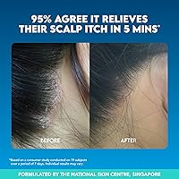 Suu Balm Dry Scalp Treatment Spray 1.35oz — image 5