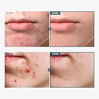 TOSOWOONG Adenosine Cica Cream 100ml — image 3