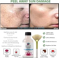 Planet Eden 88% Lactic Acid Skin Peel Kit — image 2