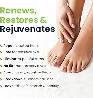 Foot Cure Callus Remover Gel & Pumice Stone Set — image 4