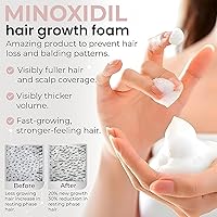 Minoxidil for Women 5% Hair Regrowth Treatment Foam 3-Month Supply — image 4