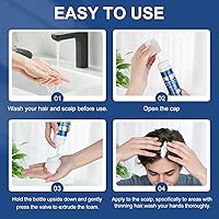 OCVWJKD 5% Minoxidil Foam for Men, Biotin-Infused, Unscented, 3-4 Month Supply — image 5