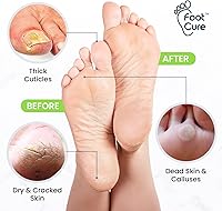 FOOT CURE Exfoliator & Callus Remover Pedicure Set – 4 Piece — image 8