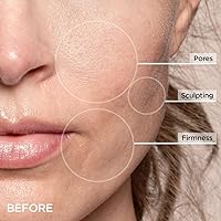 BeautyBio GloPRO Cryo Roller Duo — image 5