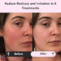 Glorio Calm Aloe Clay Masks (8 count) — image 2