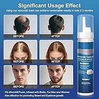 OCVWJKD 5% Minoxidil Foam for Men, Biotin-Infused, Unscented, 3-4 Month Supply — image 3