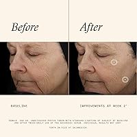 SkinMedica TNS Advanced+ Serum 1 Oz — image 3