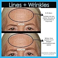 Sunday Riley Good Genes Lactic Acid Treatment 1.5oz — image 7