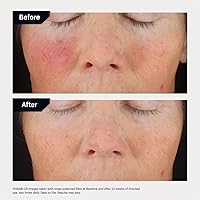 Revision Skincare C+ Correcting Complex 30% Vitamin C Serum 1oz — image 6