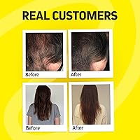 Herbtonics Hair Growth Vitamins for Women & Men, 120 Vegan Capsules — image 5