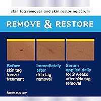 Dr. Scholl's Complete Care Skin TAG Remover, 12 Ct — image 5