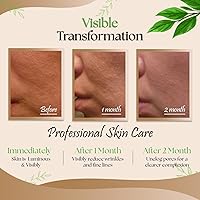 Derma Detox Rejuvenating Facial Night Cream with Retinol, Tepezcohuite & Niacinamide 1oz — image 3