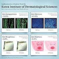 GYH Cloud-SS RB-030 LED Face Mask — image 6