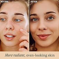 Beauty by Earth Vitamin C Face Serum — image 2