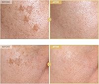 TOSOWOONG Black Snail Ginseng Serum 30ml — image 3