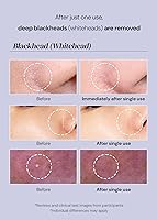 THANKYOU FARMER Pollufree Pore Deep Cleansing Oil 200mL — image 5