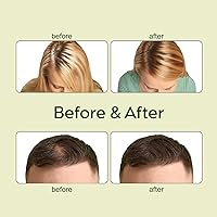 Veganic Natural Hair Growth Oil Kit — image 6