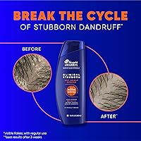 Head & Shoulders Clinical Dandruff Defense + Dry Scalp Rescue Shampoo 13.5oz — image 4