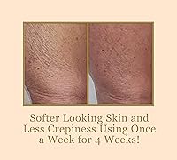 DIAMONDBUFF Microderm Exfoliation Tool — image 4