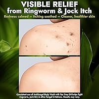 Terramed Antifungal Body Wash with Tea Tree Oil 16.9 oz — image 7