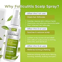 Rida Folliculitis Scalp Spray 5.61oz — image 4