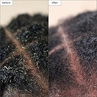 Briogeo Scalp Revival Charcoal + Tea Tree Scalp Treatment 1oz — image 3