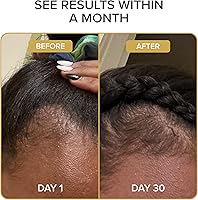 Shedavi Iconic Vegan Hair Serum 2oz — image 5