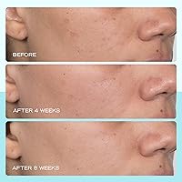 First Aid Beauty Dark Spot Serum, 1 oz — image 4