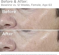 SkinMedica Total Defense + Repair SPF 34 Sunscreen for Face, 2.3 Oz — image 4