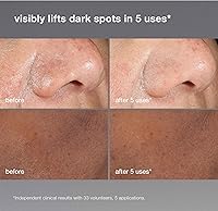 Dermalogica PowerBright Dark Spot Face Peel 1.7 fl oz — image 6