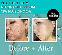 Naturium Niacinamide Face Serum 12% Plus Zinc 2% Jumbo 2oz — image 5