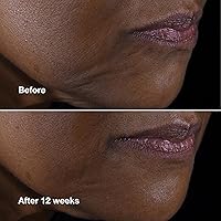 Clinique Smart Clinical Repair Anti Aging Lifting Face + Neck Cream 50mL — image 5