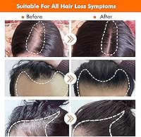 Hair Growth Kit Biotin Serum 2oz — image 4