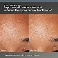 Dermalogica Daily Microfoliant Exfoliator 2.61oz — image 3