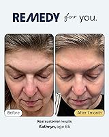 Remedy for Healthy Aging Nightly Treatment — image 3