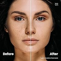 Bliss Republic Dark Spot Remover Serum 15ml — image 5