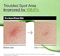 Anua Azelaic Acid 10% Hyaluron Redness Soothing Serum 30mL — image 5