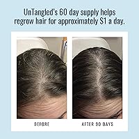 Foundation Skincare UnTangled Hair Vitamins 60-Day Supply — image 5