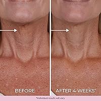 DEKLIDERM Neck Firming Cream 1.69oz — image 4