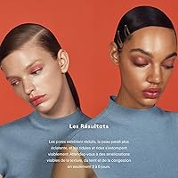 U Beauty Resurfacing Compound Serum 1.0 fl.oz — image 5