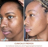 Dr. Dennis Gross Alpha Beta Universal Daily Peel (60 Treatments) — image 7