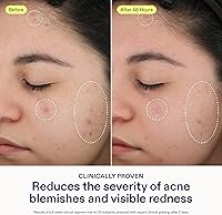 Skinfix 2% BHA Spot Treatment 0.5oz — image 3