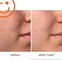 Kate Somerville ExfoliKate Intensive Exfoliating Treatment 2oz — image 3