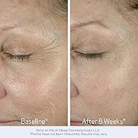 Obagi ELASTIderm Eye Cream 0.5oz — image 3