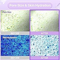 BIOHEAL BOH ProBioderm Collagen Remodeling Serum Gel Mask (6ea X 34g) — image 4