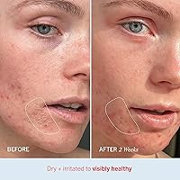 First Aid Beauty Ultra Repair Cream 170mL — image 5