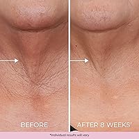 DEKLIDERM Neck Firming Cream 1.69oz — image 5