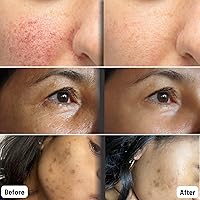 ORGAID Organic Sheet Mask - Vitamin C & Revitalizing (Pack of 4) — image 7