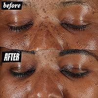 Kiehl's Clearly Corrective Dark Spot Serum 0.5oz — image 3