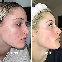 Bohemia Skin BOHO Skin Cleansing Balm 2oz — image 5